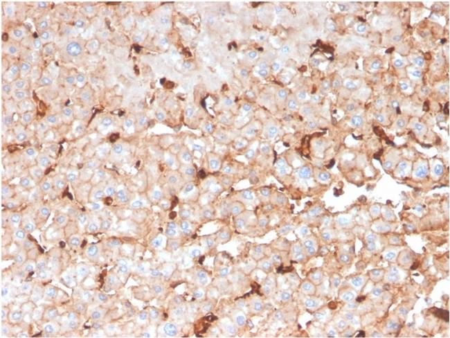 Apolipoprotein D/APOD Antibody in Immunohistochemistry (Paraffin) (IHC (P))