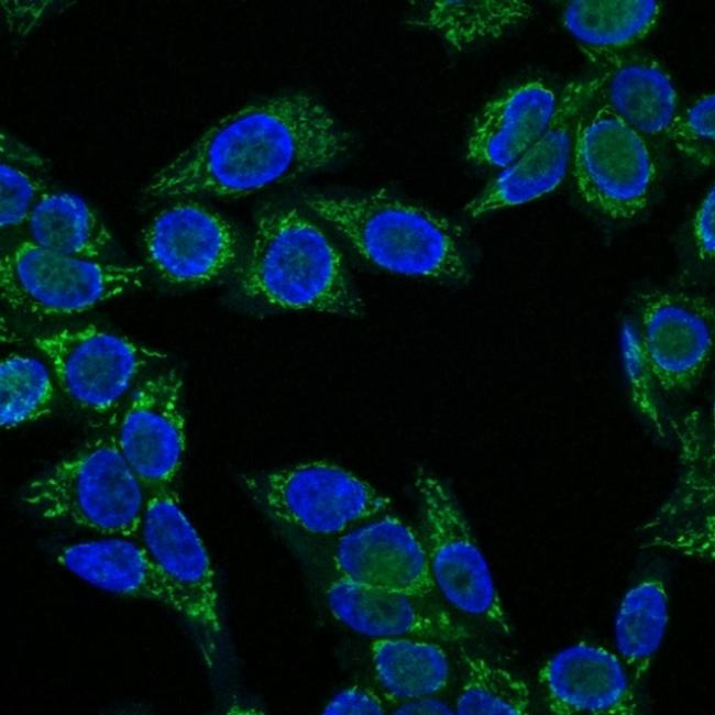 Insulin-like Growth Factor-1 (IGF-1) Antibody in Immunocytochemistry (ICC/IF)