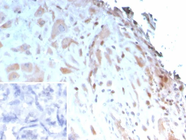 IGFBP3 Antibody in Immunohistochemistry (Paraffin) (IHC (P))