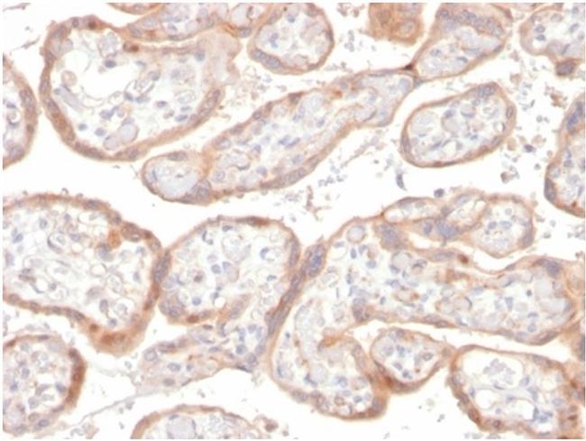 IGFBP3 Antibody in Immunohistochemistry (Paraffin) (IHC (P))