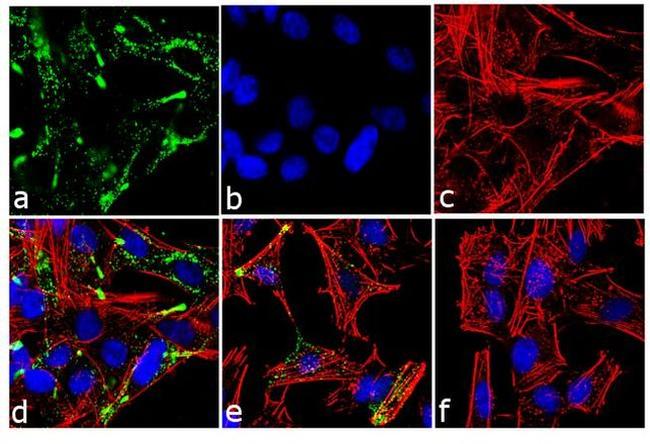 c-Kit Antibody in Immunocytochemistry (ICC/IF)