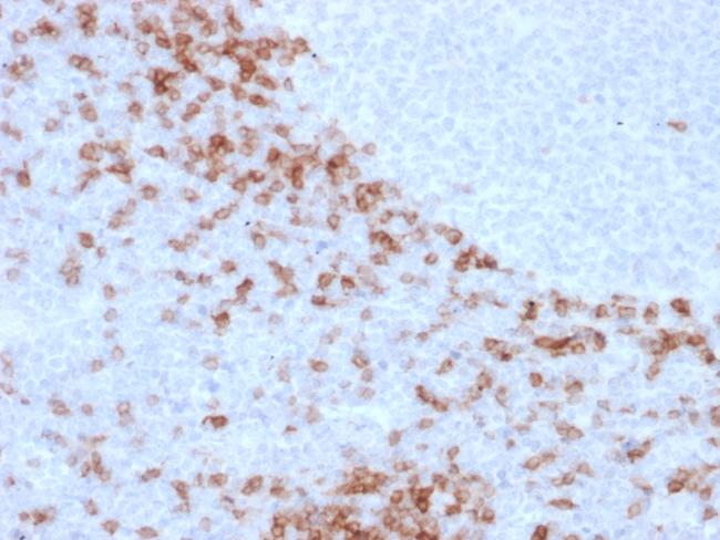 IgD (Immunoglobulin Delta Heavy Chain) (B-Cell Marker) Antibody in Immunohistochemistry (Paraffin) (IHC (P))