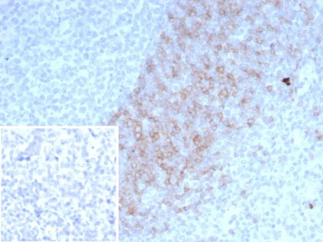 IgD (Immunoglobulin Delta Heavy Chain) (B-Cell Marker) Antibody in Immunohistochemistry (Paraffin) (IHC (P))