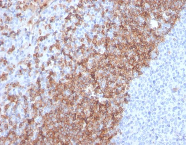 IgD (Immunoglobulin Delta Heavy Chain) (B-Cell Marker) Antibody in Immunohistochemistry (Paraffin) (IHC (P))