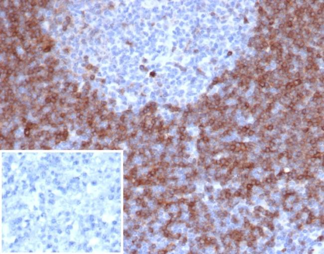 IgD (Immunoglobulin Delta Heavy Chain) (B-Cell Marker) Antibody in Immunohistochemistry (Paraffin) (IHC (P))