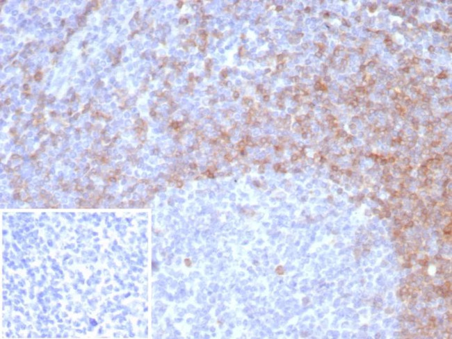 IgD (Immunoglobulin Delta Heavy Chain) (B-Cell Marker) Antibody in Immunohistochemistry (Paraffin) (IHC (P))