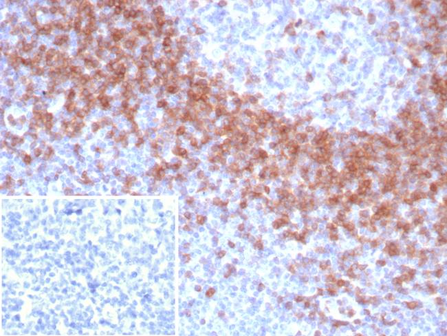 IgD (Immunoglobulin Delta Heavy Chain) (B-Cell Marker) Antibody in Immunohistochemistry (Paraffin) (IHC (P))