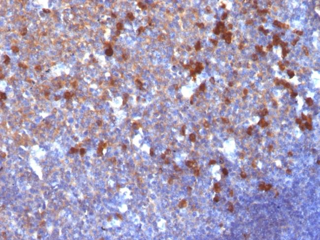 IgG (Immunoglobulin Gamma Heavy Chain) (B-Cell Marker) Antibody in Immunohistochemistry (Paraffin) (IHC (P))