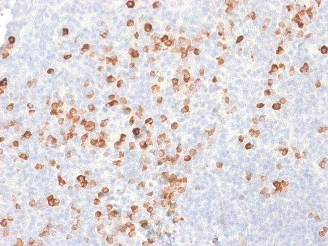 IgG (Immunoglobulin Gamma Heavy Chain) Antibody in Immunohistochemistry (Paraffin) (IHC (P))