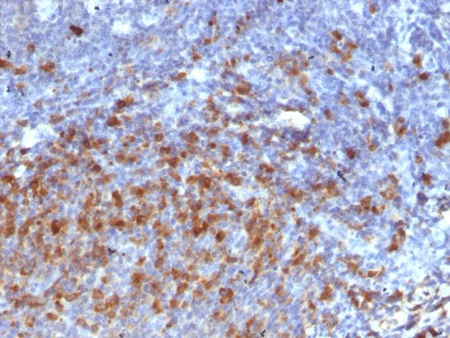 IgG (Immunoglobulin Gamma Heavy Chain) (B-Cell Marker) Antibody in Immunohistochemistry (Paraffin) (IHC (P))