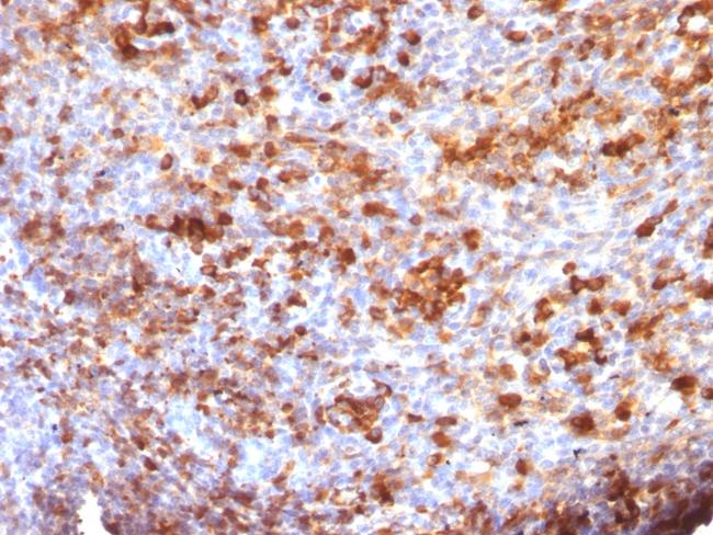 IgG (Immunoglobulin Gamma Heavy Chain) (B-Cell Marker) Antibody in Immunohistochemistry (Paraffin) (IHC (P))