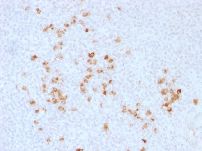 IgG (Immunoglobulin Gamma Heavy Chain) (B-Cell Marker) Antibody in Immunohistochemistry (Paraffin) (IHC (P))