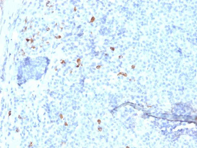 IgG4 (Ig Heavy Constant Gamma 4) (G4m Marker) Antibody in Immunohistochemistry (Paraffin) (IHC (P))