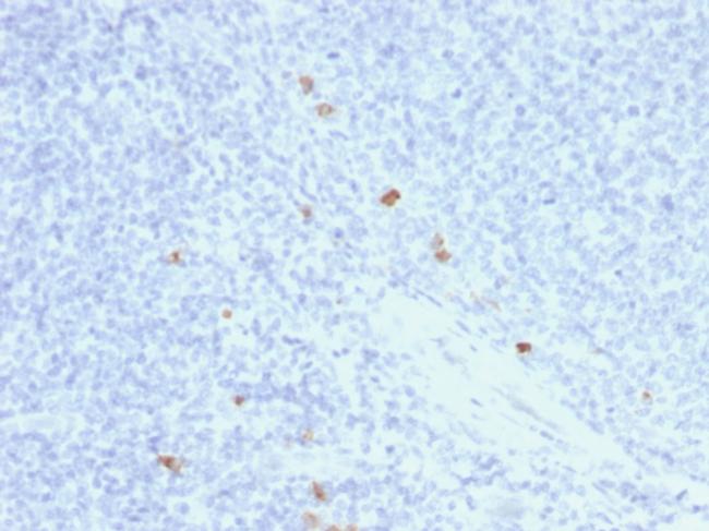 IgG4 (Ig Heavy Constant Gamma 4) Antibody in Immunohistochemistry (Paraffin) (IHC (P))