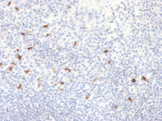 IgG4 (Ig Heavy Constant Gamma 4) Antibody in Immunohistochemistry (Paraffin) (IHC (P))