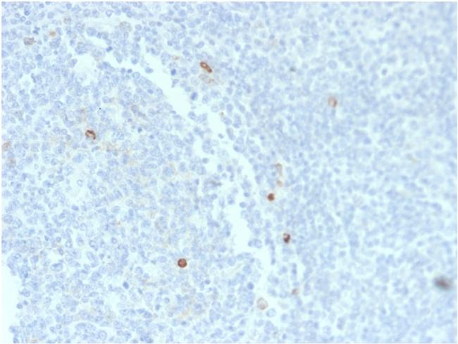 IgM (Immunoglobulin Mu Heavy Chain) Antibody in Immunohistochemistry (Paraffin) (IHC (P))