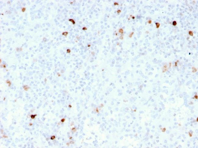 IgM (Immunoglobulin Mu Heavy Chain) Antibody in Immunohistochemistry (Paraffin) (IHC (P))