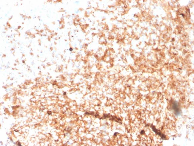 IgM (Immunoglobulin Mu Heavy Chain) (B-Cell Marker) Antibody in Immunohistochemistry (Paraffin) (IHC (P))