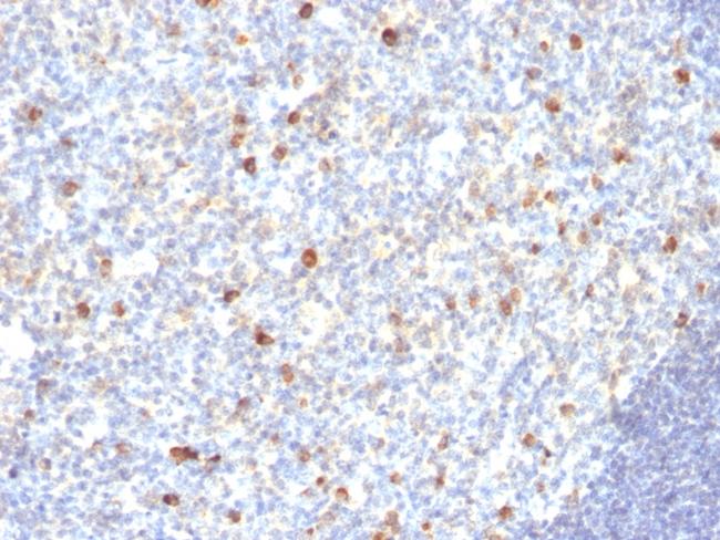 IgM (Immunoglobulin Mu Heavy Chain) (B-Cell Marker) Antibody in Immunohistochemistry (Paraffin) (IHC (P))