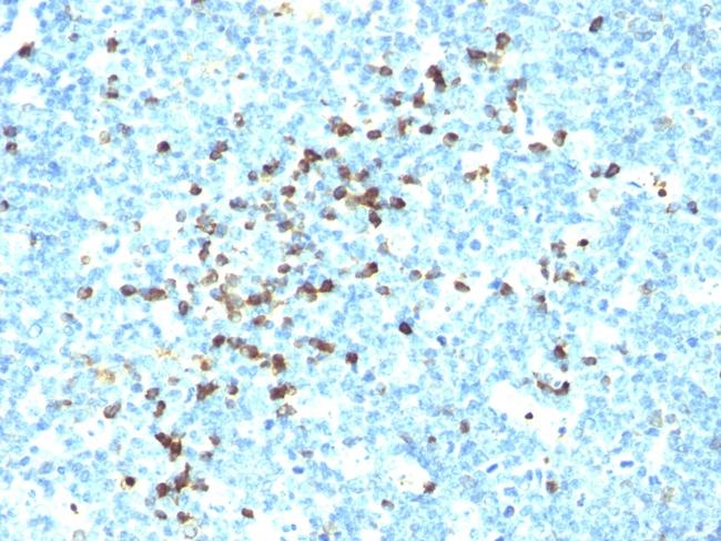 IgM (Immunoglobulin Mu Heavy Chain) (B-Cell Marker) Antibody in Immunohistochemistry (Paraffin) (IHC (P))