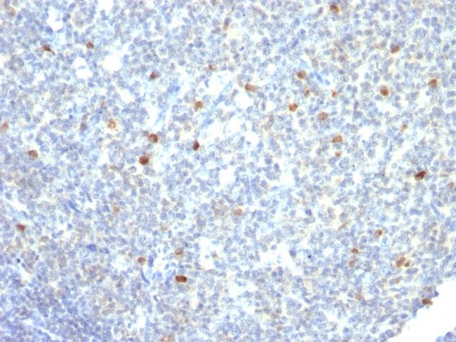 IgM (Immunoglobulin Mu Heavy Chain) (B-Cell Marker) Antibody in Immunohistochemistry (Paraffin) (IHC (P))