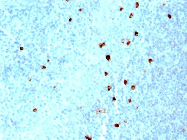 IgM (Immunoglobulin Mu Heavy Chain) (B-Cell Marker) Antibody in Immunohistochemistry (Paraffin) (IHC (P))