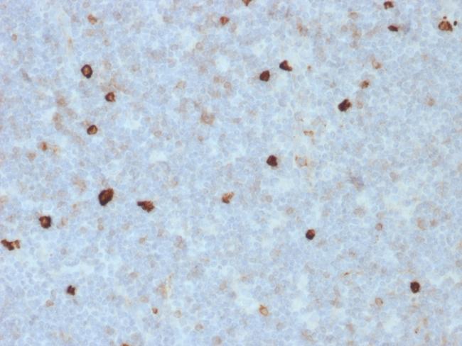 IgM (Immunoglobulin Mu Heavy Chain) (B-Cell Marker) Antibody in Immunohistochemistry (Paraffin) (IHC (P))