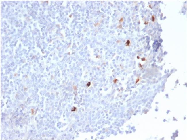 IgM (Immunoglobulin Mu Heavy Chain) Antibody in Immunohistochemistry (Paraffin) (IHC (P))