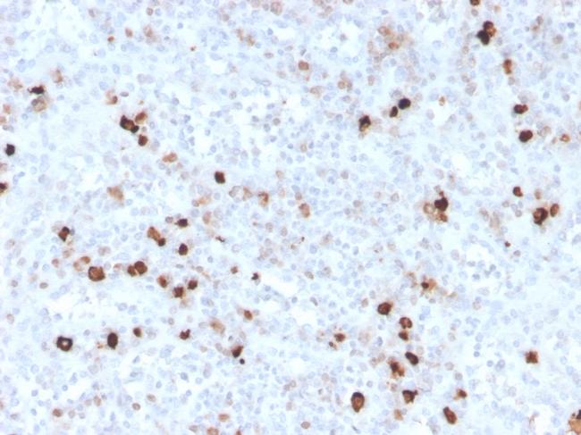 IgM (Immunoglobulin Mu Heavy Chain) Antibody in Immunohistochemistry (Paraffin) (IHC (P))