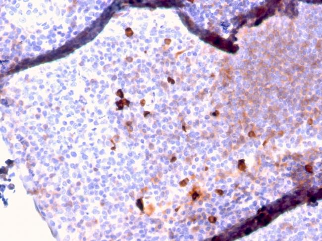 IgM (Immunoglobulin Mu Heavy Chain) Antibody in Immunohistochemistry (Paraffin) (IHC (P))