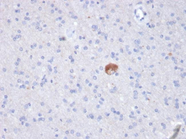 beta Amyloid Antibody in Immunohistochemistry (Paraffin) (IHC (P))