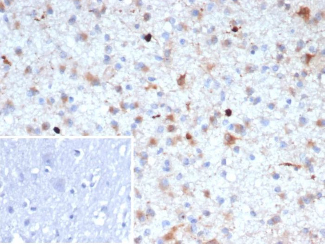 beta Amyloid Antibody in Immunohistochemistry (Paraffin) (IHC (P))