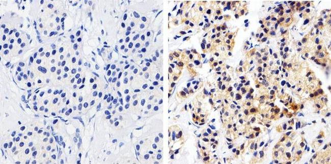 MMP2 Antibody in Immunohistochemistry (Paraffin) (IHC (P))