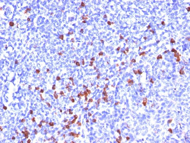 Kappa Light Chain (B-Cell Marker) Antibody in Immunohistochemistry (Paraffin) (IHC (P))