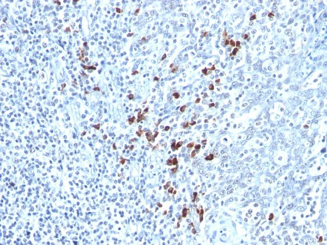 Kappa Light Chain (B-Cell Marker) Antibody in Immunohistochemistry (Paraffin) (IHC (P))