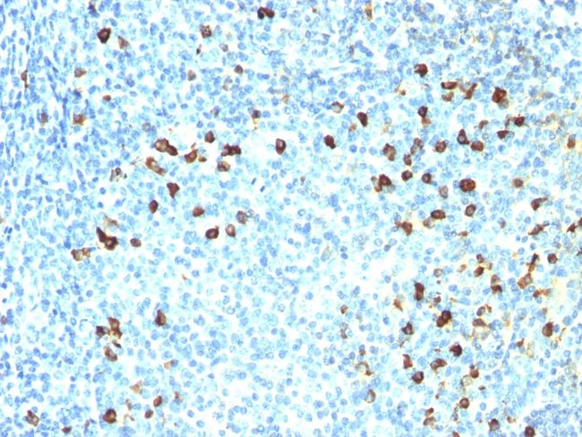 Kappa Light Chain (B-Cell Marker) Antibody in Immunohistochemistry (Paraffin) (IHC (P))