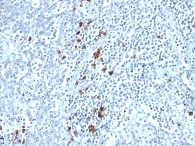 Kappa Light Chain (B-Cell Marker) Antibody in Immunohistochemistry (Paraffin) (IHC (P))