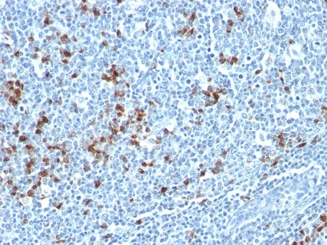 Kappa Light Chain (B-Cell Marker) Antibody in Immunohistochemistry (Paraffin) (IHC (P))