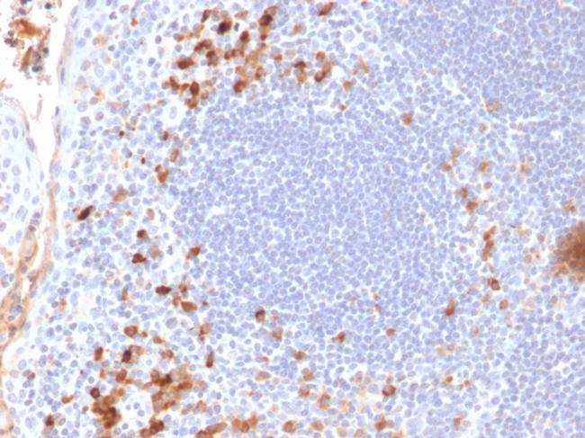 Kappa Light Chain/IGKC Antibody in Immunohistochemistry (Paraffin) (IHC (P))