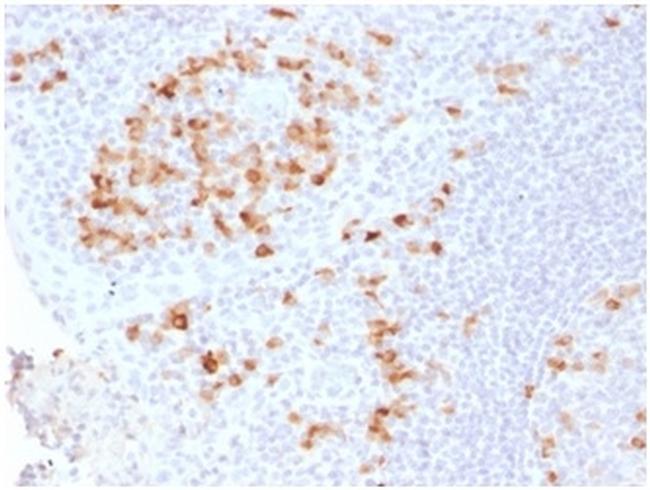 Kappa Light Chain/IGKC Antibody in Immunohistochemistry (Paraffin) (IHC (P))