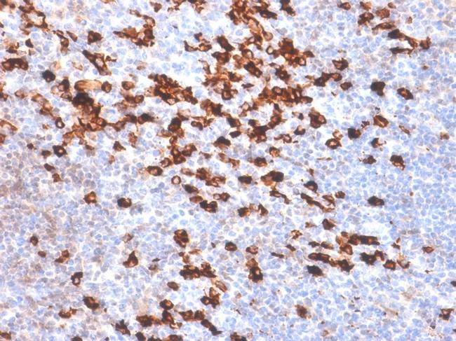 Kappa Light Chain Antibody in Immunohistochemistry (Paraffin) (IHC (P))