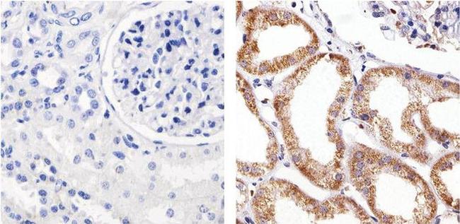 Claudin 5 Antibody in Immunohistochemistry (Paraffin) (IHC (P))