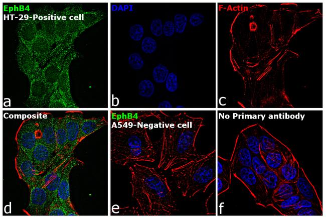 EphB4 Antibody in Immunocytochemistry (ICC/IF)