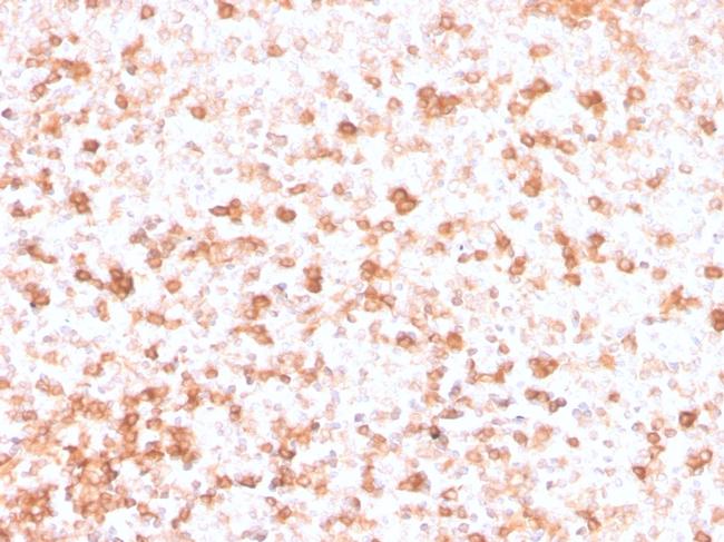 Lambda Light Chain Antibody in Immunohistochemistry (Paraffin) (IHC (P))