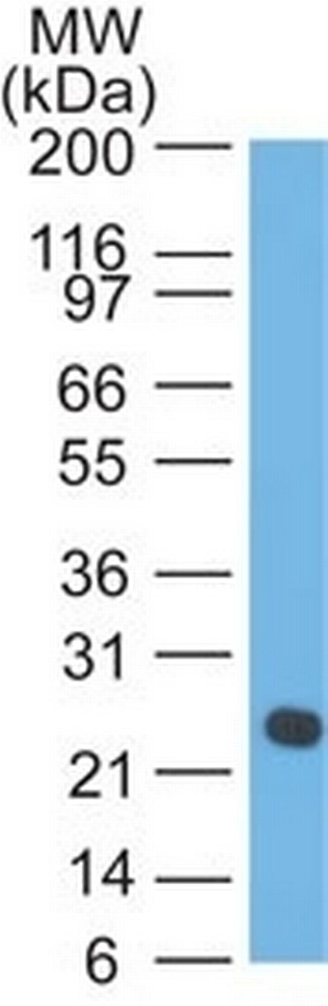 Lambda Light Chain (B-Cell Marker) Antibody in Western Blot (WB)