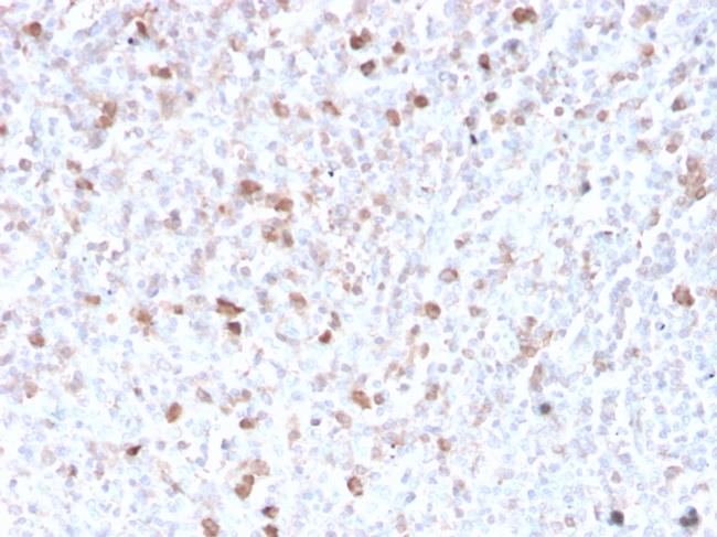 Lambda Light Chain Antibody in Immunohistochemistry (Paraffin) (IHC (P))