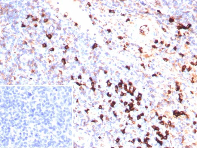 Lambda Light Chain (B-Cell Marker) Antibody in Immunohistochemistry (Paraffin) (IHC (P))