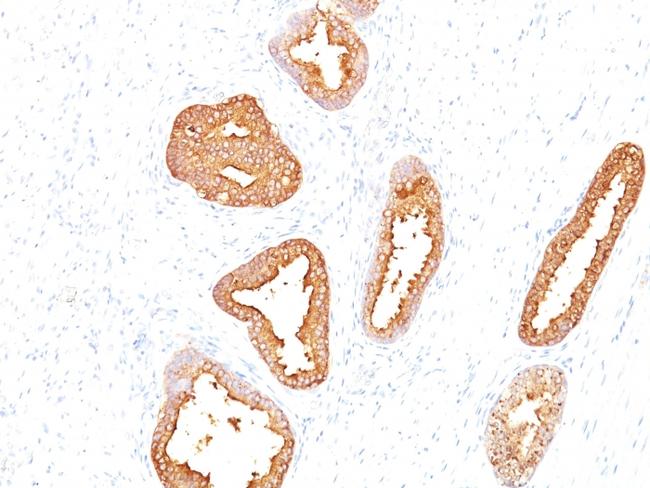 Prostate Specific Antigen (PSA) Antibody in Immunohistochemistry (Paraffin) (IHC (P))