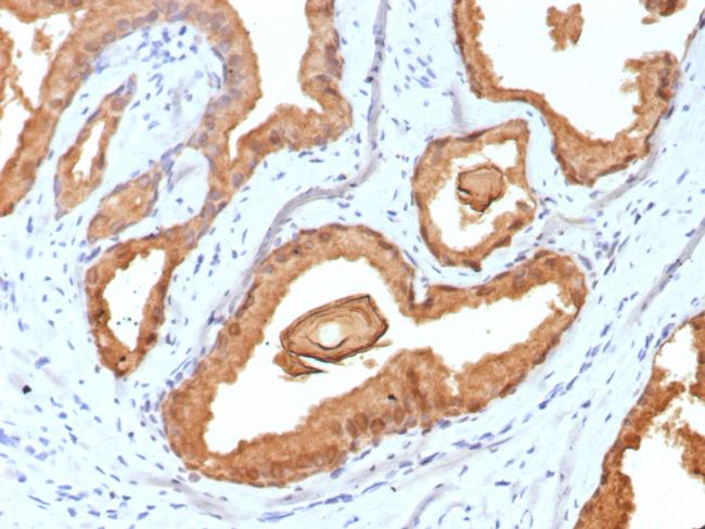 Prostate Specific Antigen (PSA) Antibody in Immunohistochemistry (Paraffin) (IHC (P))