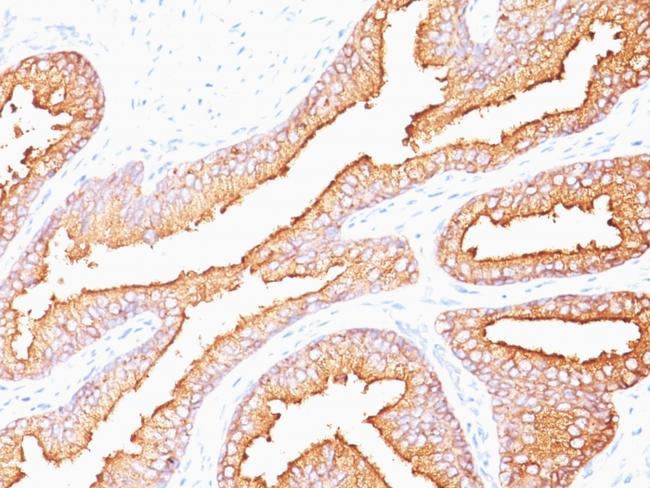 Prostate Specific Antigen (PSA) Antibody in Immunohistochemistry (Paraffin) (IHC (P))